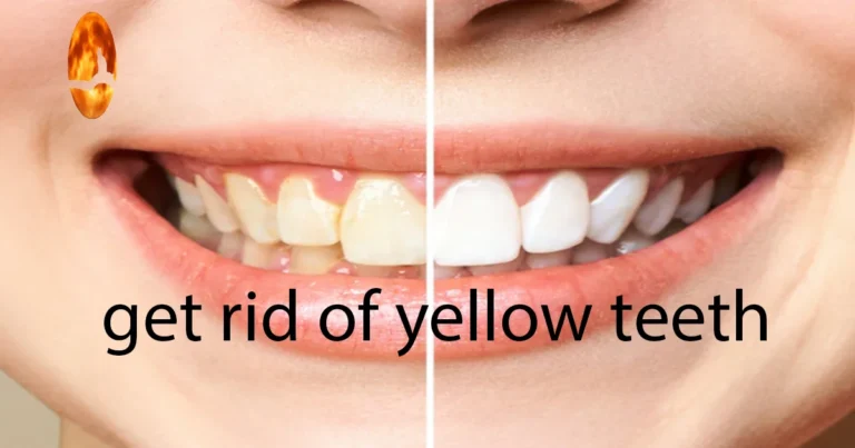 yellow teeth