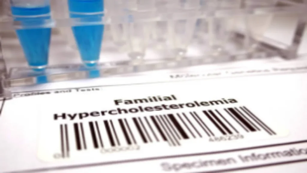 familial hypercholesterolemia test